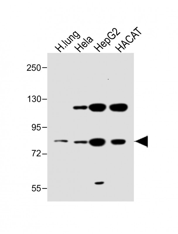 Rabbit Polyclonal Antibody to SLC6A14