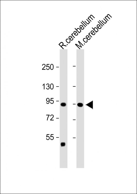 Rabbit Polyclonal Antibody to TRPV1 (N-term)