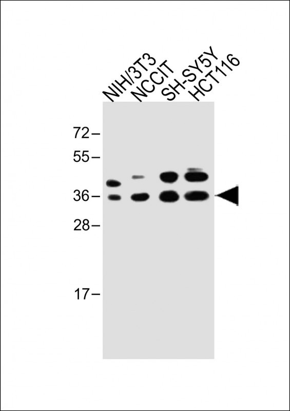 Rabbit Polyclonal Antibody to WDR82 (N-term)