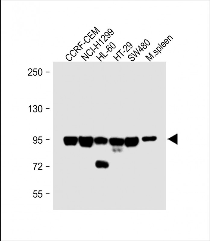 Rabbit Polyclonal Antibody to NOD1