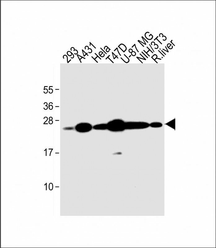 Rabbit Polyclonal Antibody to RAB1B