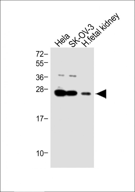 Rabbit Polyclonal Antibody to TGIF2