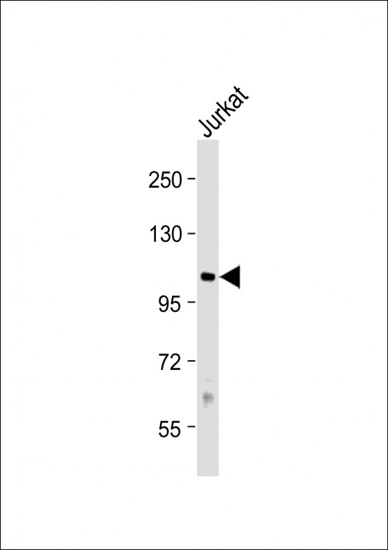 Rabbit Polyclonal Antibody to PRMT10 (N-term)