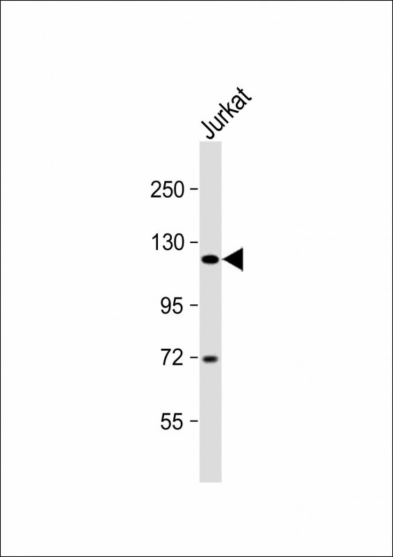 Rabbit Polyclonal Antibody to GLI2