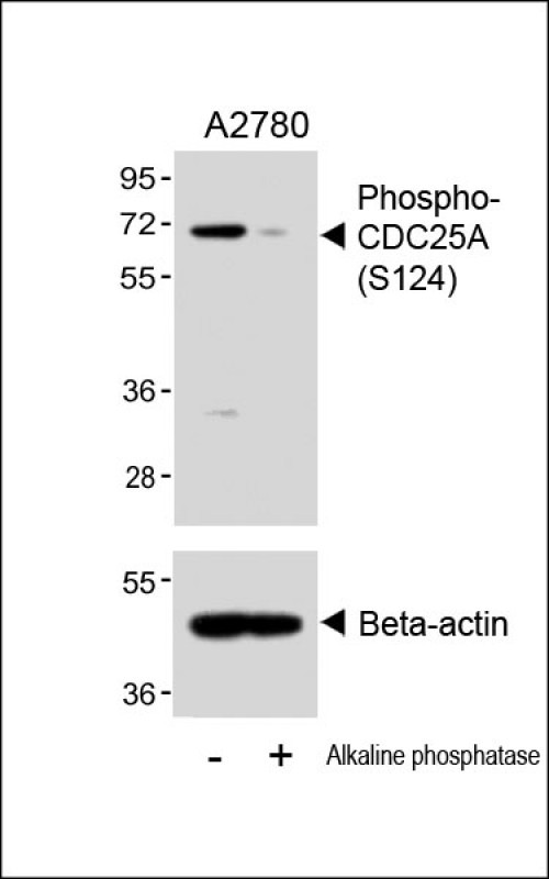 Rabbit Polyclonal Antibody to Phospho-CDC25A(S124)