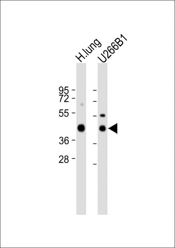 Rabbit Polyclonal Antibody to HLA-F