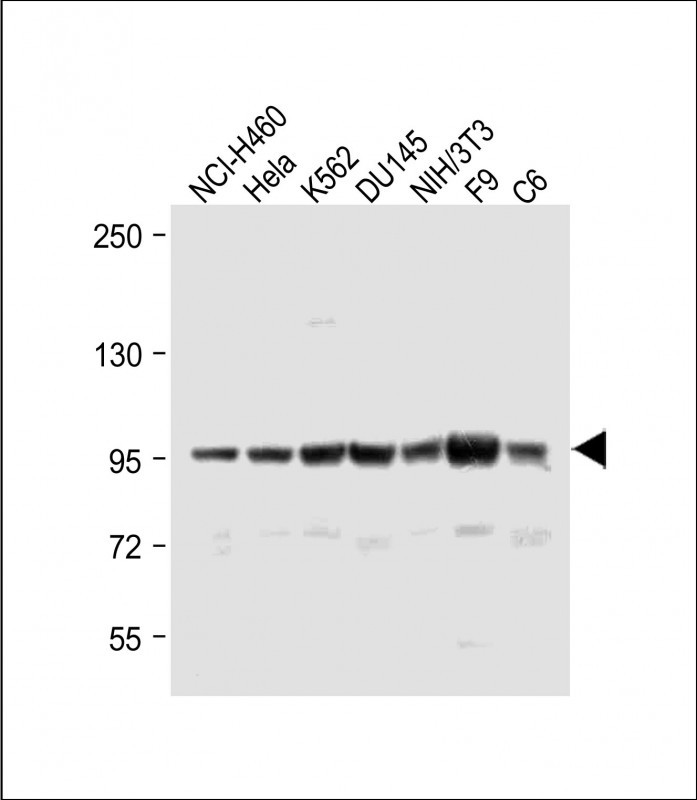 Rabbit Polyclonal Antibody to ABCF1