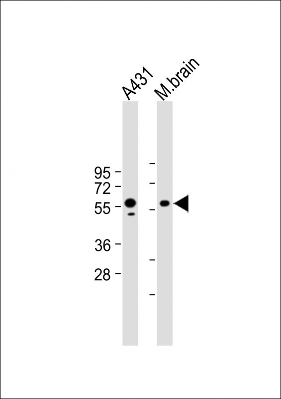 Mouse Monoclonal Antibody to PINK1