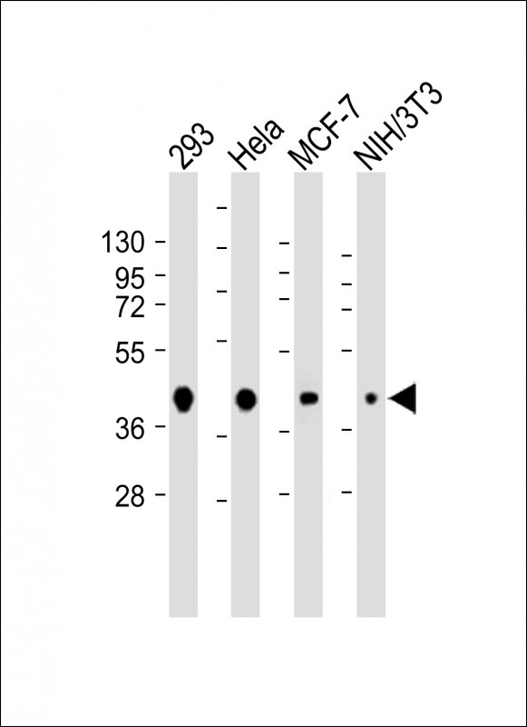 Mouse Monoclonal Antibody to AKT1S1