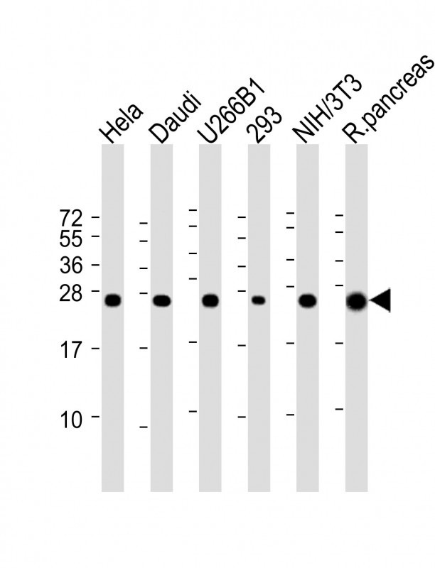 Rabbit Polyclonal Antibody to RPL10 (N-term)