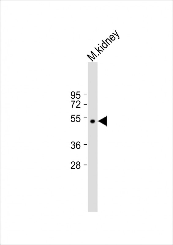 Rabbit Polyclonal Antibody to CLN3