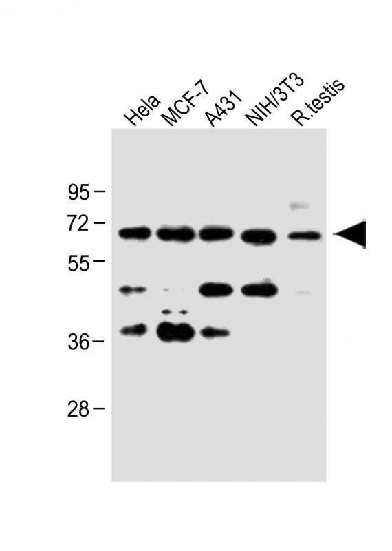 Rabbit Polyclonal Antibody to CDC25A (S124)