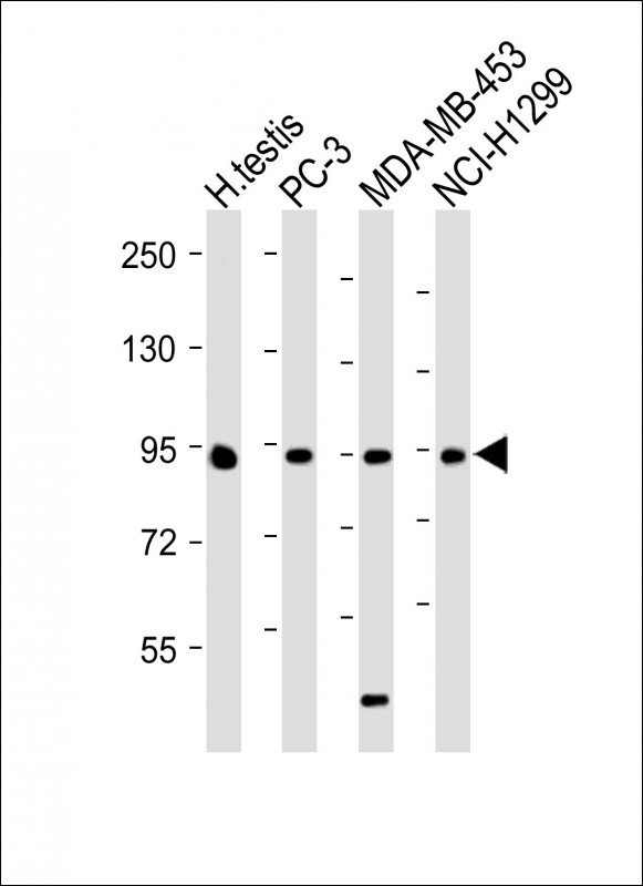 Rabbit Polyclonal Antibody to BRDT (N-term)