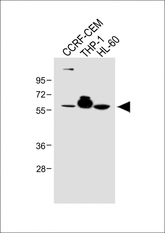 Rabbit Polyclonal Antibody to FCGR1B