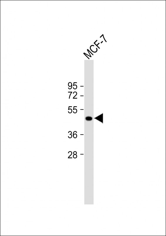 Rabbit Polyclonal Antibody to ETS2
