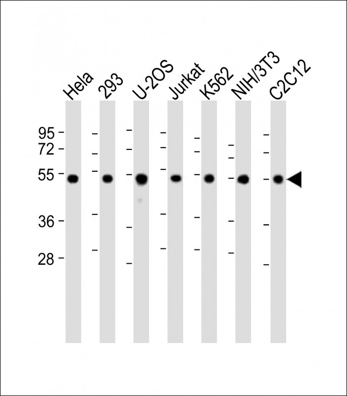 Rabbit Polyclonal Antibody to Vimentin