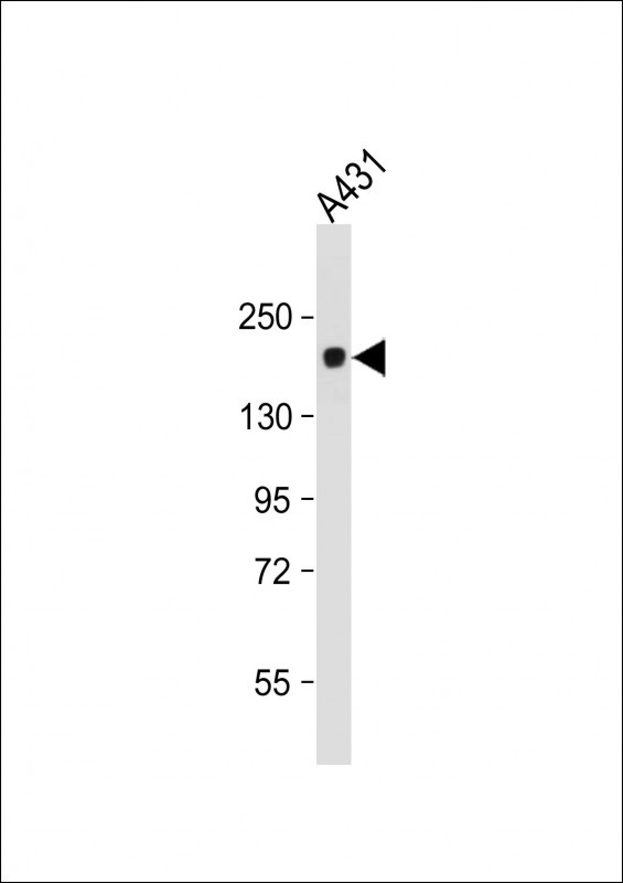 Mouse Monoclonal Antibody to PRDM10