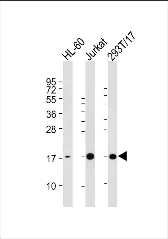 Mouse Monoclonal Antibody to SUMO3