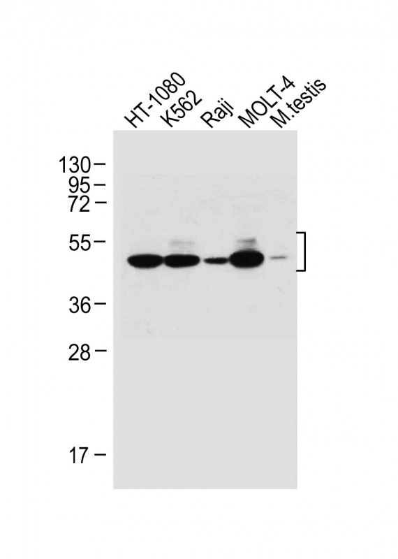 Rabbit Polyclonal Antibody to WT1 (Center E361)