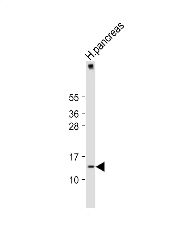 Rabbit Polyclonal Antibody to MDK