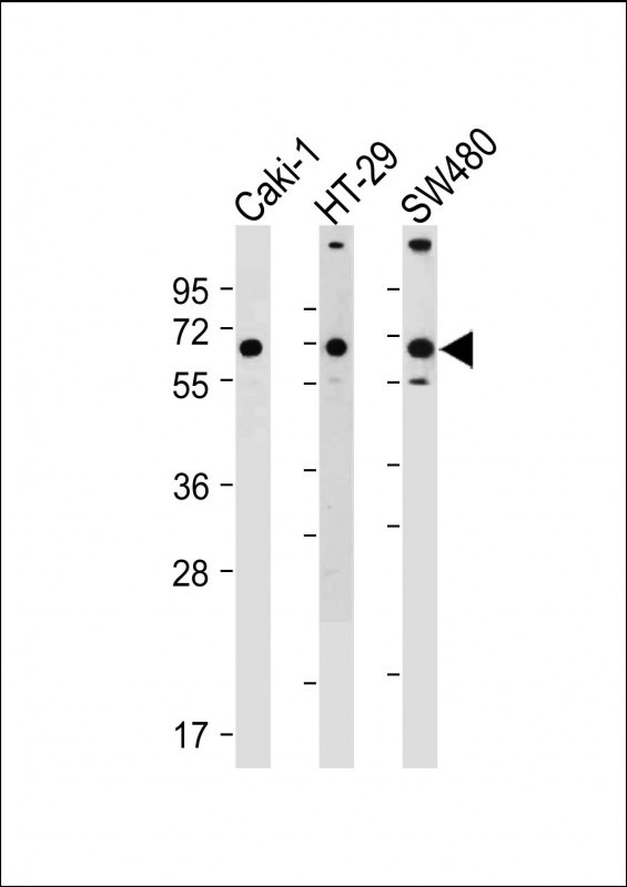Rabbit Polyclonal Antibody to SLC23A1 (N-term)