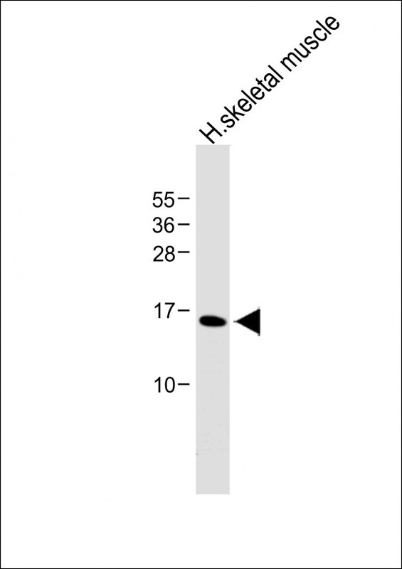Rabbit Polyclonal Antibody to EMP1 (N-term)