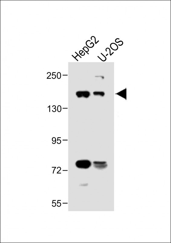 Rabbit Polyclonal Antibody to ABCB4