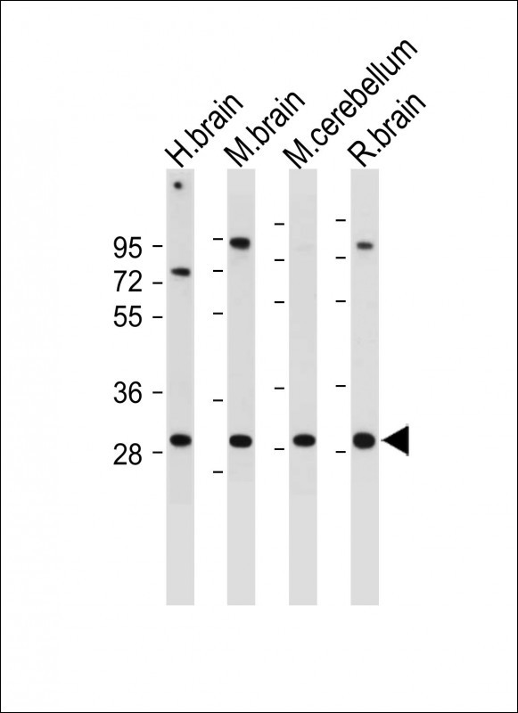 Rabbit Polyclonal Antibody to CABP1