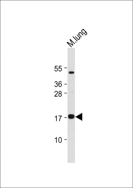 Rabbit Polyclonal Antibody to IER3 (N-term)