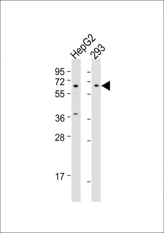 Rabbit Polyclonal Antibody to BTRC (N-term)