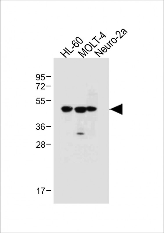 Rabbit Polyclonal Antibody to BLMH