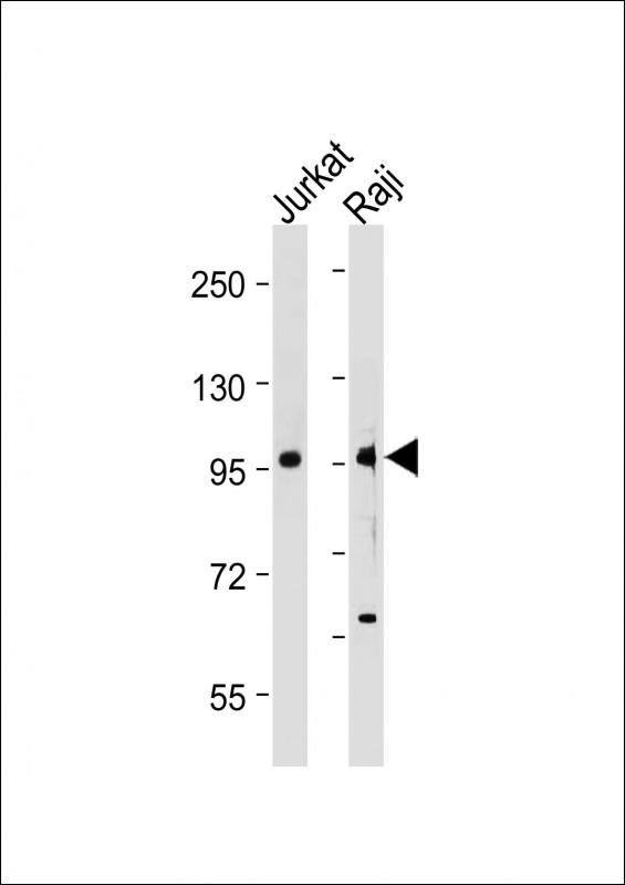 Rabbit Polyclonal Antibody to MAP4K1(Y381)