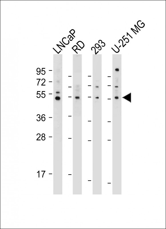 Rabbit Polyclonal Antibody to OTUD3