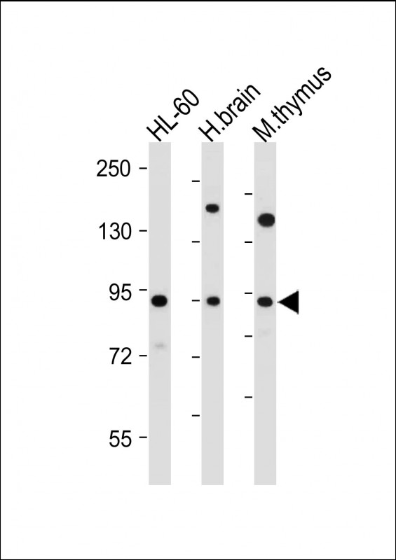 Rabbit Polyclonal Antibody to ENASE