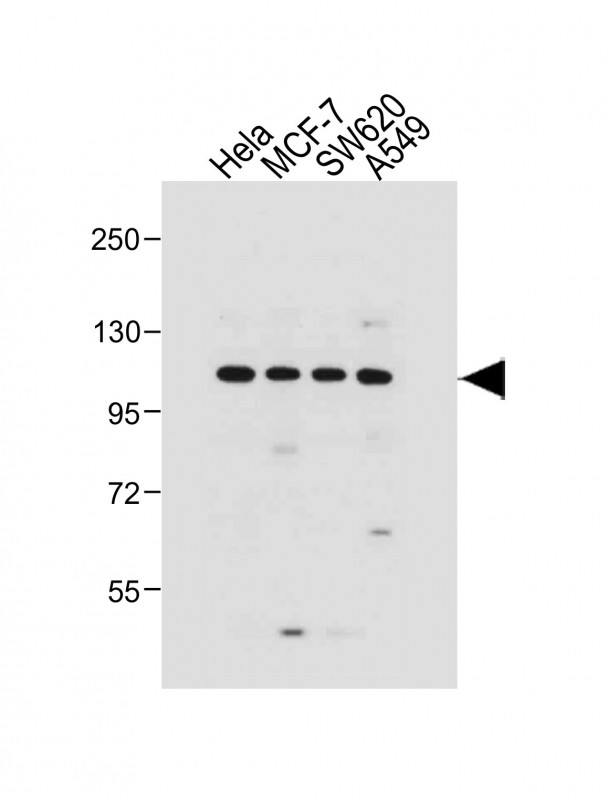 Rabbit Polyclonal Antibody to GAA (N-term)