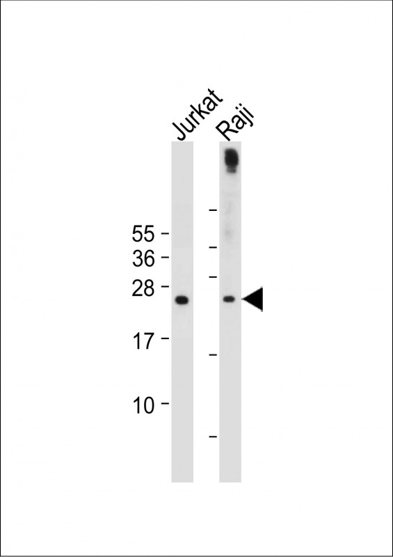 Rabbit Polyclonal Antibody to PHO1 (N-term)