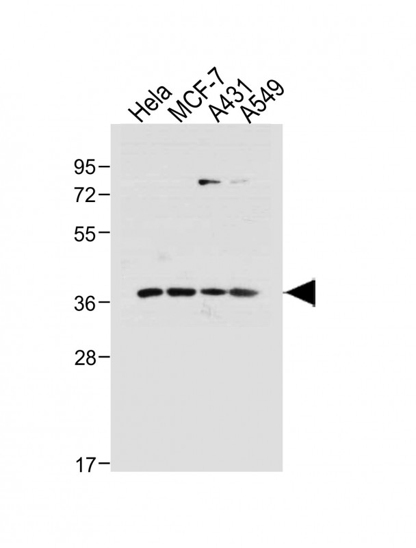 Rabbit Polyclonal Antibody to hCdk7-T170
