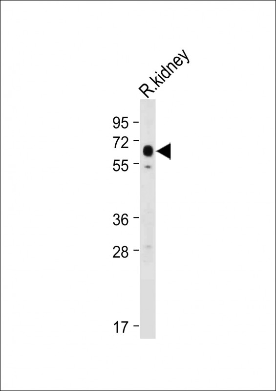 Rabbit Polyclonal Antibody to S47A2 (N-term)