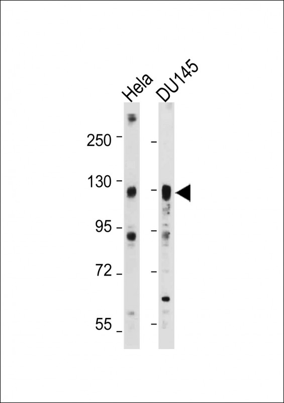 Rabbit Polyclonal Antibody to AXL