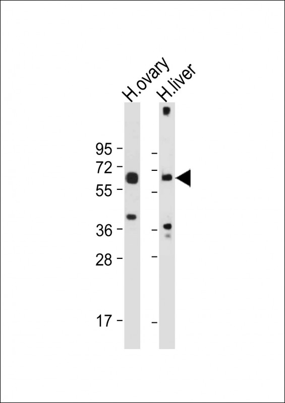 Rabbit Polyclonal Antibody to POTEB