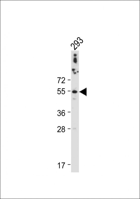 Rabbit Polyclonal Antibody to CTSA (N-term)