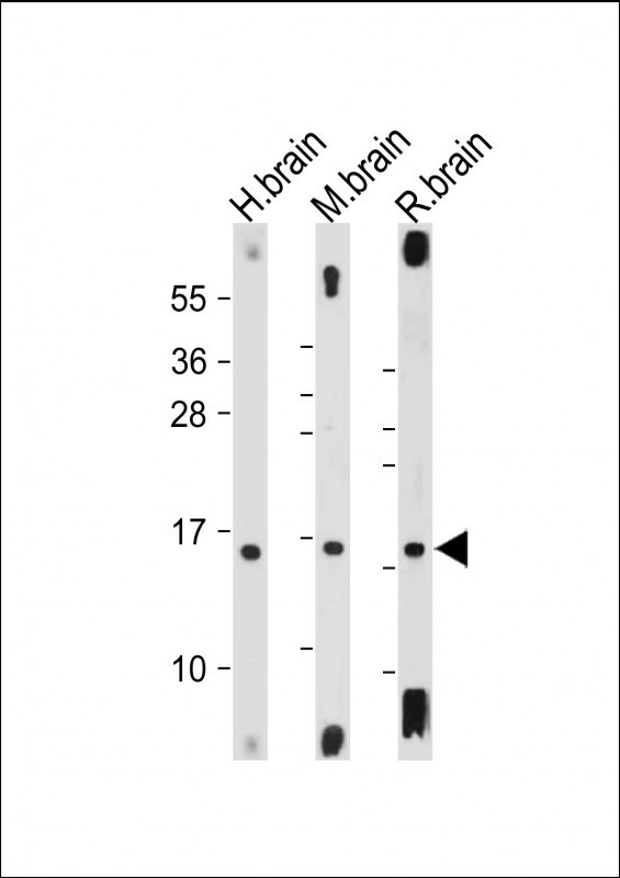 Rabbit Polyclonal Antibody to MAP1LC3A(N-term)