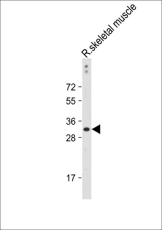 Rabbit Polyclonal Antibody to DIO3