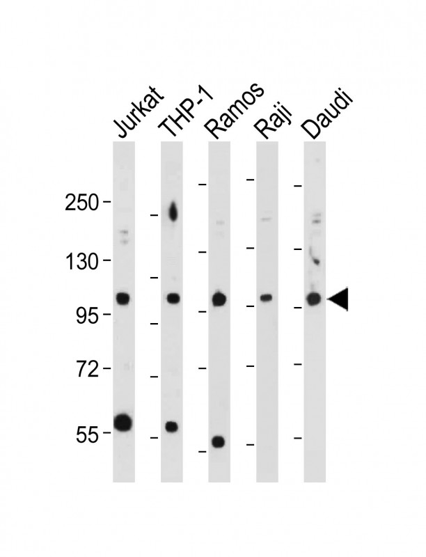Rabbit Polyclonal Antibody to MAP4K1-T165