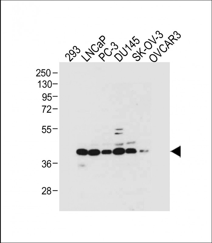 Rabbit Polyclonal Antibody to STRA8