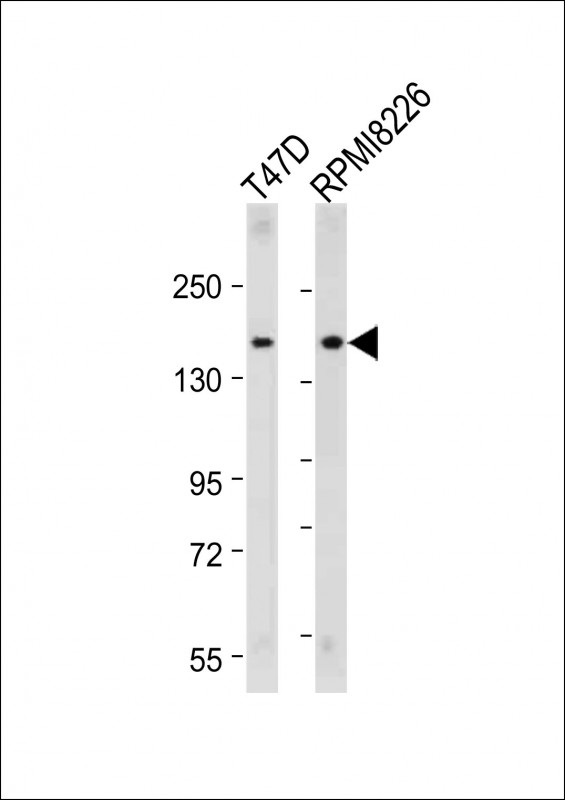 Rabbit Polyclonal Antibody to ABCC12