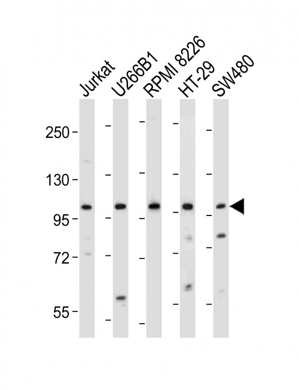 Rabbit Polyclonal Antibody to NLRP6 (N-term)