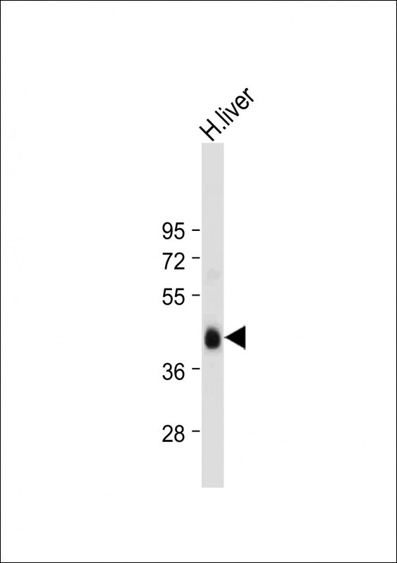 Rabbit Polyclonal Antibody to ADIPOR2