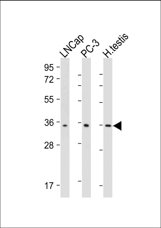 Mouse Monoclonal Antibody to RNF4