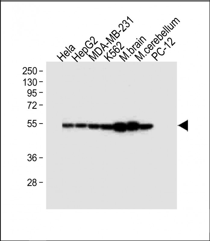 Rabbit Polyclonal Antibody to TUBB2B (N-term)